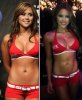 Brittney-palmer-before-after-surgery.jpg