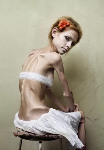 bulimia-anorexia.jpg